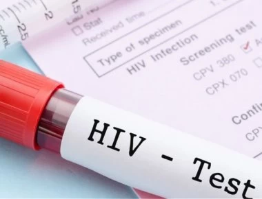 Έτσι μεταδόθηκε το AIDS στον άνθρωπο!